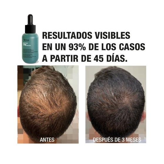 TAHE PROGRAMA ANTICAIDA: CONCENTRADO 200ML +...